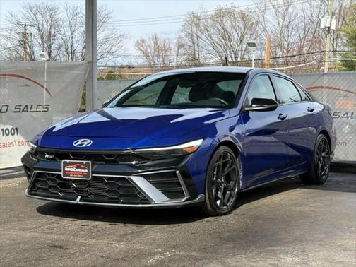 2024 Hyundai ELANTRA SE