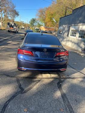 2015 Acura TLX V6