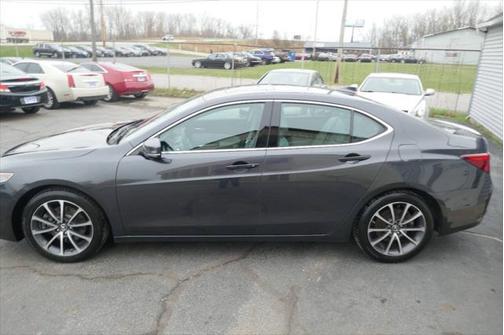 2015 Acura TLX V6 Tech