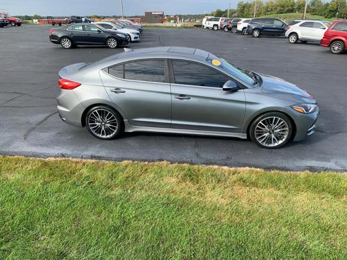 2018 Hyundai ELANTRA Sport