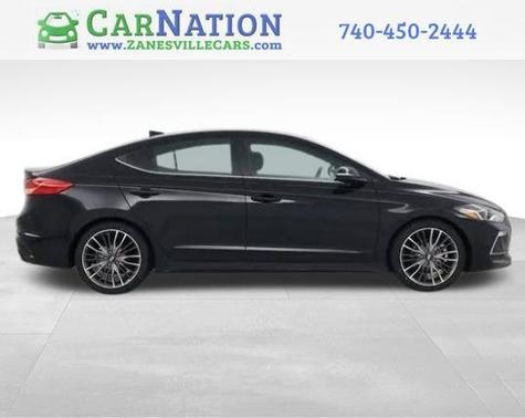 2018 Hyundai ELANTRA Sport