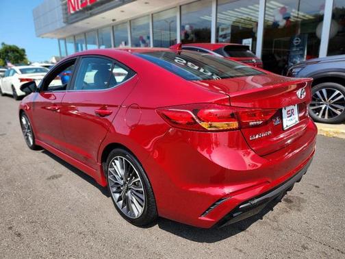 2017 Hyundai ELANTRA Sport