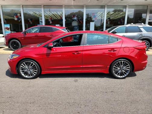 2017 Hyundai ELANTRA Sport