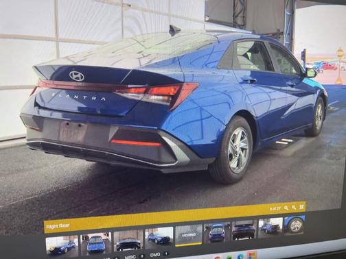 2024 Hyundai ELANTRA SE