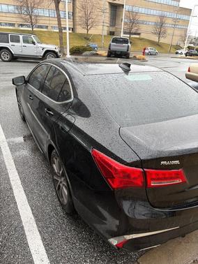 2018 Acura TLX Technology