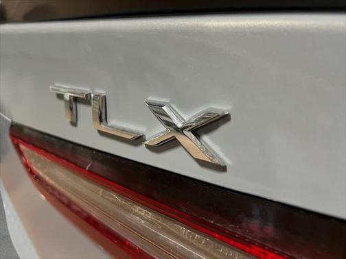 2025 Acura TLX A-Spec