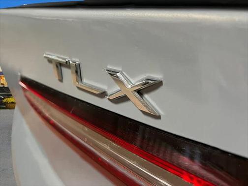2025 Acura TLX A-Spec