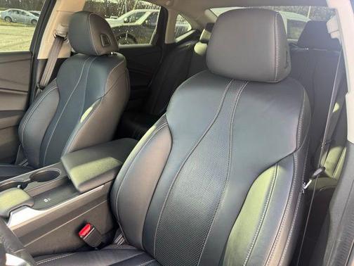 2024 Acura TLX Technology