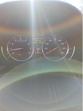 2018 Acura TLX Technology