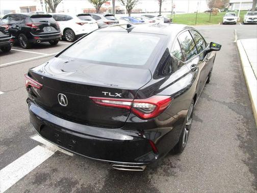 2025 Acura TLX Technology