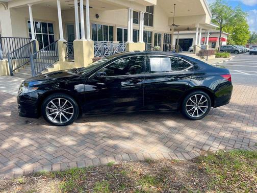 BLACK 2016 Acura TLX V6 Advance