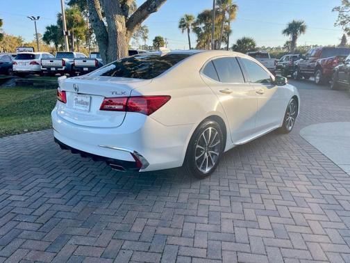 2018 Acura TLX Technology