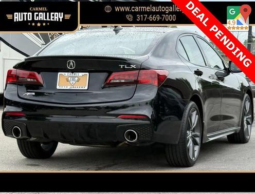 2018 Acura TLX Technology
