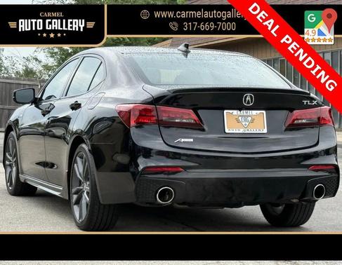 2018 Acura TLX Technology