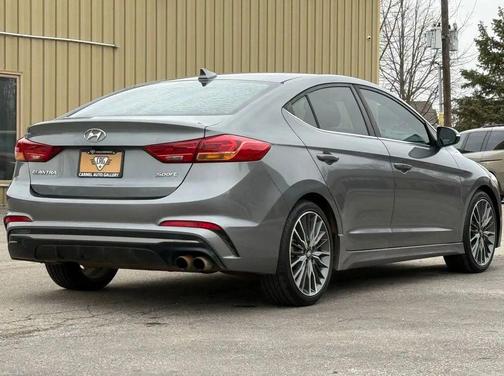 2018 Hyundai ELANTRA Sport