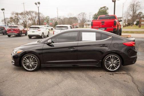 2018 Hyundai ELANTRA Sport