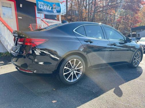 2015 Acura TLX V6