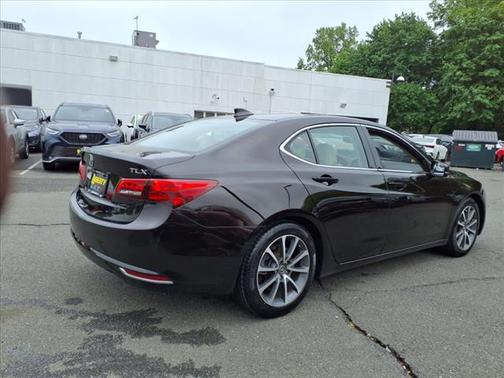 2015 Acura TLX V6 Tech