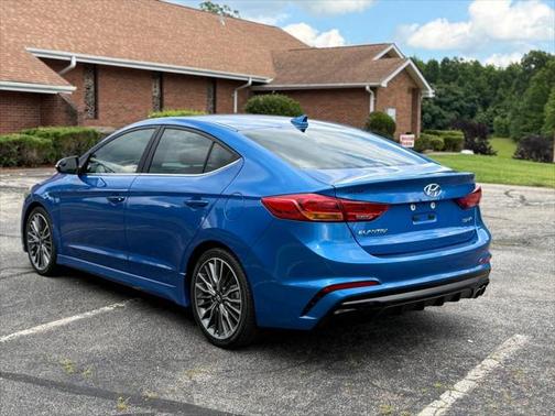 2017 Hyundai ELANTRA Sport
