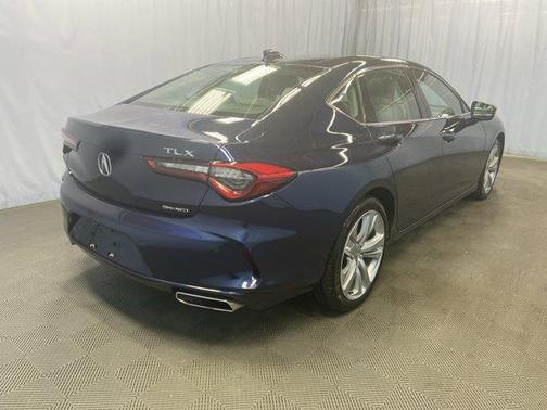 2021 Acura TLX Technology