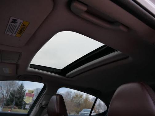 2015 Acura TLX V6 Tech