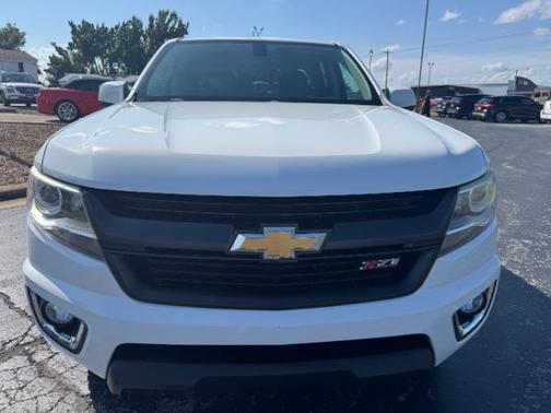 2018 Chevrolet Colorado Z71