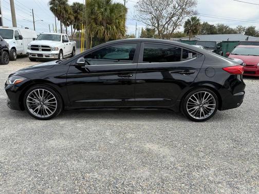 2018 Hyundai ELANTRA Sport