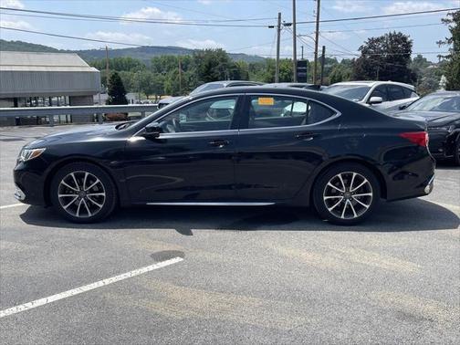 2018 Acura TLX Technology