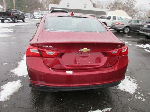 2017 Chevrolet Malibu 1LT