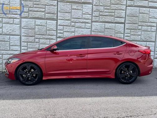 2017 Hyundai ELANTRA Sport