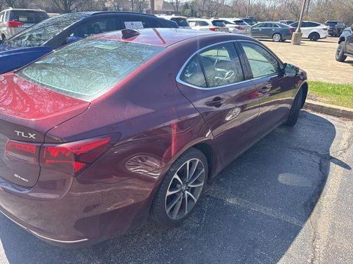 2015 Acura TLX V6 Advance