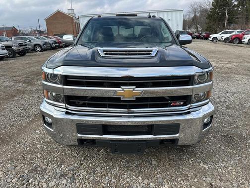 2018 Chevrolet Silverado 2500 LTZ