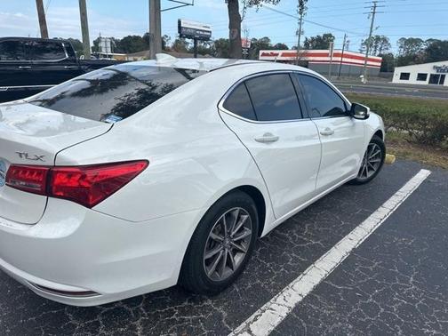 2020 Acura TLX Technology