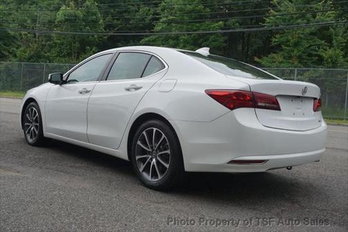 2017 Acura TLX w/Technology Package
