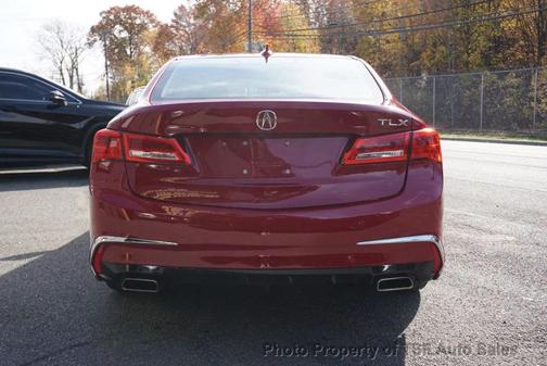 2018 Acura TLX Technology