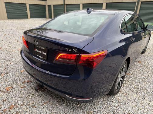 2017 Acura TLX w/Technology Package