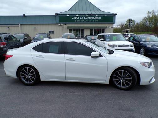 2018 Acura TLX V6
