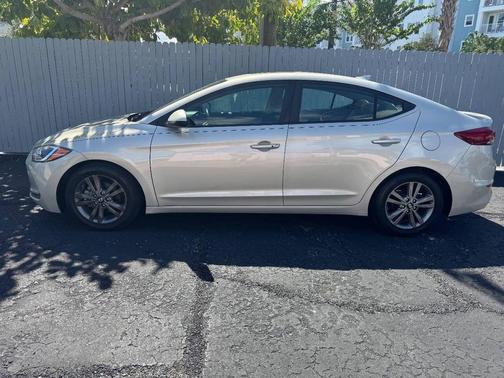 2017 Hyundai ELANTRA SE Value Edition