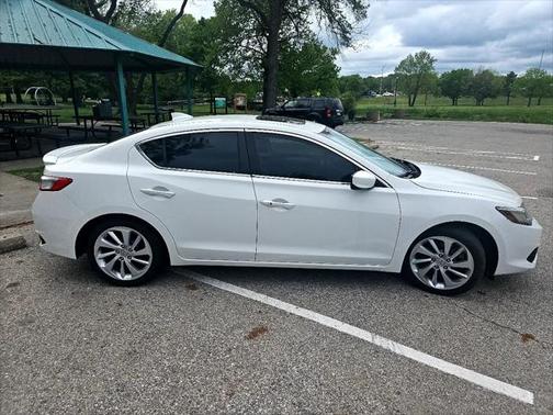 2017 Acura ILX Technology Plus Package