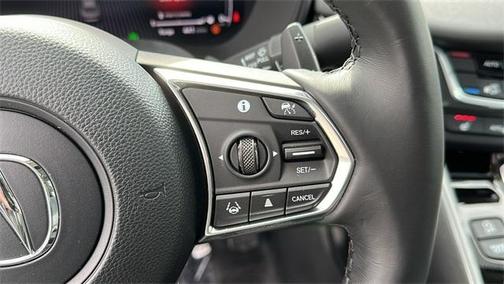 2025 Acura TLX Technology