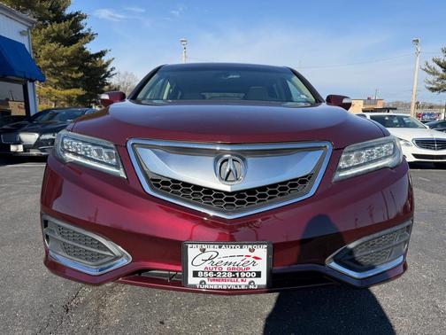 2017 Acura RDX Technology Package