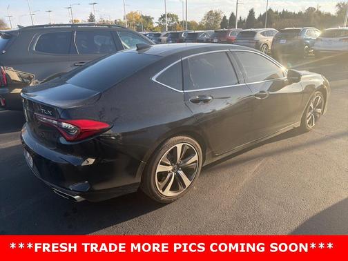 2025 Acura TLX Technology