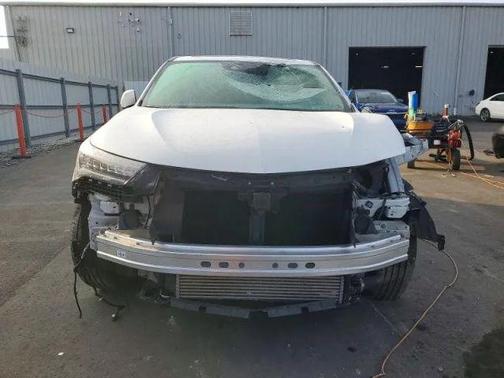 2022 Acura RDX Technology Package