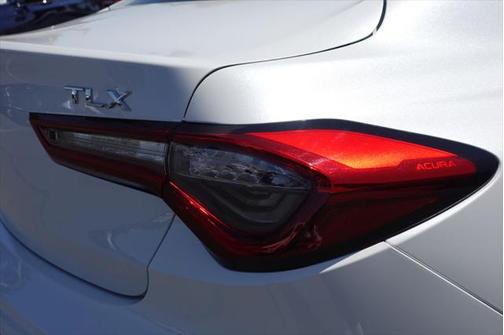 2025 Acura TLX Technology