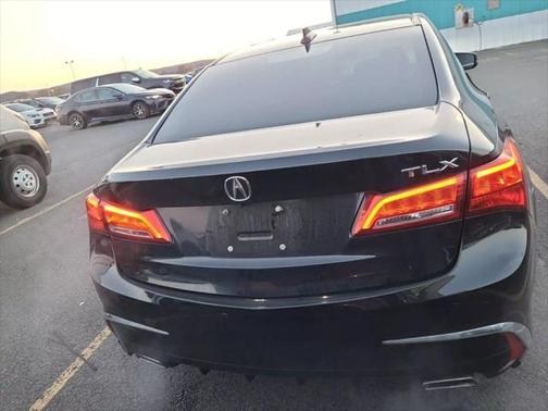 2020 Acura TLX Technology