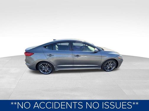 2017 Hyundai ELANTRA Sport