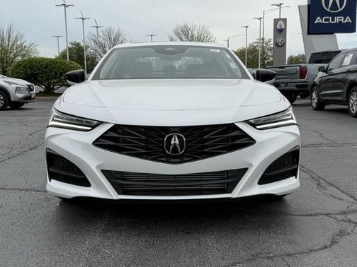 2025 Acura TLX Technology