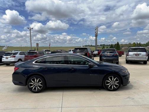 2017 Chevrolet Malibu 1LT