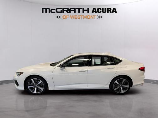 2025 Acura TLX Technology