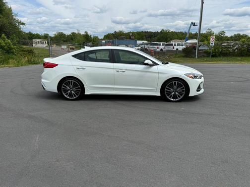 Ceramic White 2018 Hyundai ELANTRA Sport